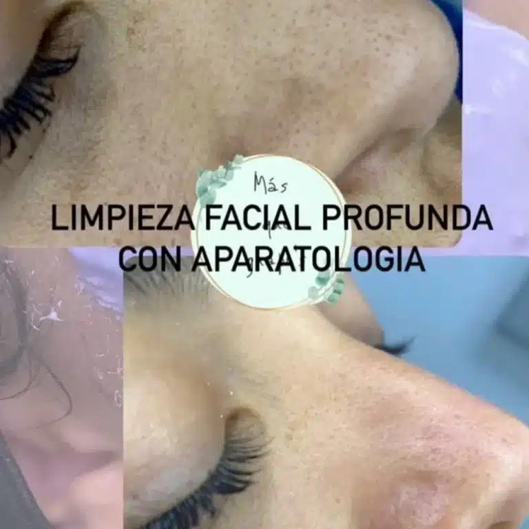 Limpieza facial